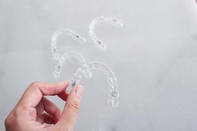 インビザラインのマウスピースが浮く原因と対処法